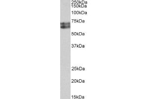 ABIN4902656 (0. (HDC anticorps)