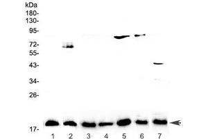 Western blot testing of 1) placenta, 2) PANC-1, 3) rat lymph, 4) rat small intestine, 5) rat testis, 6) rat ovary, and 7) mouse testis lysate with IL-23 antibody at 0. (IL23A anticorps)