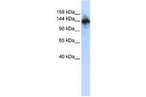 Western Blotting (WB) image for anti-RNA Binding Motif Protein 6 (RBM6) antibody (ABIN2457899) (RBM6 anticorps)