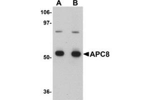 Western blot analysis of APC8 in K562 cell lysate with APC8 antibody at (A) 1 and (B) 2 μg/ml. (CDC23 anticorps  (Center))