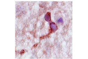 Complexin 2 in human hippocampus was delected using HRP/AEC red color stain.