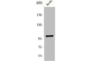 Western Blot analysis of HuvEc cells using NARG1 Polyclonal Antibody (NAA15 anticorps  (Internal Region))