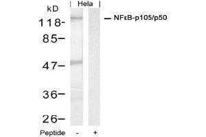 Image no. 1 for anti-Nuclear Factor of kappa Light Polypeptide Gene Enhancer in B-Cells 1 (NFKB1) (Ser927) antibody (ABIN319348) (NFKB1 anticorps  (Ser927))