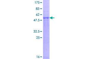 Image no. 1 for Proteasome (Prosome, Macropain) Subunit, beta Type, 8 (Large Multifunctional Peptidase 7) (PSMB8) (AA 1-272) protein (GST tag) (ABIN1316593)