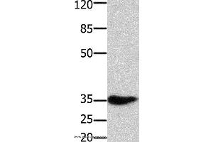 Western blot analysis of Mouse muscle tissue, using HOXA11 Polyclonal Antibody at dilution of 1:350 (Homeobox A11 anticorps)