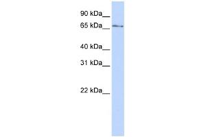 WB Suggested Anti-KLHL26 Antibody Titration:  0. (KLHL26 anticorps  (N-Term))