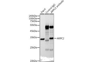 Immunoprecipitation analysis of 300 μg extracts of HepG2 cells using 3 μg  antibody (ABIN7265385).