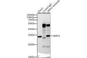 Immunoprecipitation analysis of 300 μg extracts of HepG2 cells using 3 μg  antibody (ABIN7265385). (ARPC2 anticorps)