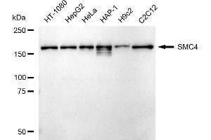Western blotting analysis using SMC4 antibody (ABIN7800449). (Recombinant SMC4 anticorps)