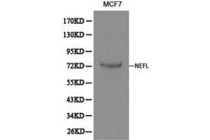 Western Blotting (WB) image for anti-Neurofilament, Light Polypeptide (NEFL) antibody (ABIN1873871) (NEFL anticorps)