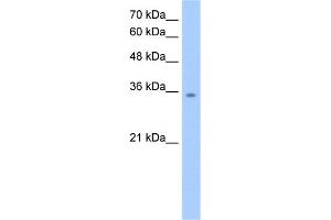 WB Suggested Anti-MDH2 Antibody Titration:  2. (MDH2 anticorps  (C-Term))
