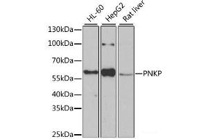 Western blot analysis of extracts of various cell lines using PNKP Polyclonal Antibody at dilution of 1:1000. (PNKP anticorps)