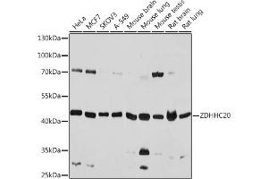 Western blot analysis of extracts of various cell lines, using ZDHHC20 antibody (ABIN7271551) at 1:1000 dilution. (ZDHHC20 anticorps)