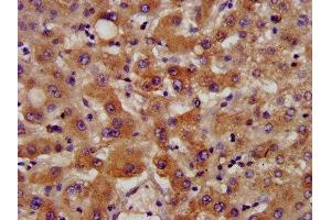 IHC image of ABIN7170786 diluted at 1:400 and staining in paraffin-embedded human liver tissue performed on a Leica BondTM system.