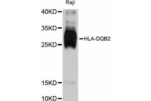 Western blot analysis of extracts of Raji cells, using HLA-DQB2 antibody (ABIN5997902) at 1:3000 dilution. (HLA-DQB2 anticorps)