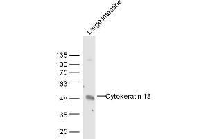 Rat Large intestine lysates probed with Cytokeratin 18 Polyclonal Antibody, Unconjugated  at 1:300 dilution and 4˚C overnight incubation.