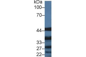 Western blot analysis of Pig Liver lysate, using Human IL13Ra1 Antibody (2 µg/ml) and HRP-conjugated Goat Anti-Rabbit antibody ( (IL13 Receptor alpha 1 anticorps  (AA 203-376))