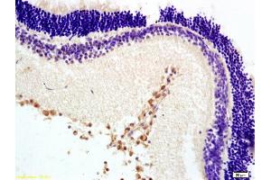 Formalin-fixed and paraffin embedded rat retina labeled with Anti-MTNR1B Polyclonal Antibody, Unconjugated (ABIN730318) at 1:200 followed by conjugation to the secondary antibody and DAB staining. (Melatonin Receptor 1B anticorps  (AA 201-300))