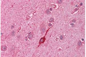 Human Brain, Cortex (formalin-fixed, paraffin-embedded) stained with HMOX2 antibody ABIN214113 at 5 ug/ml followed by biotinylated goat anti-rabbit IgG secondary antibody ABIN481713, alkaline phosphatase-streptavidin and chromogen.