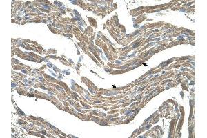 Asporin antibody was used for immunohistochemistry at a concentration of 4-8 ug/ml to stain Skeletal muscle cells (arrows) in Human Muscle. (Asporin anticorps  (Middle Region))