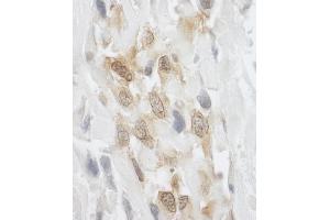 Immunohistochemistry (IHC) image for anti-Lipoma-preferred partner (LPP) (AA 75-125) antibody (ABIN7448631)