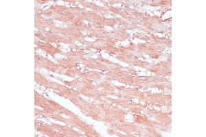 Immunohistochemistry of paraffin-embedded rat heart using RPL30 antibody (ABIN6130903, ABIN6147135, ABIN6147136 and ABIN6217777) at dilution of 1:100 (40x lens). (RPL30 anticorps  (AA 1-115))