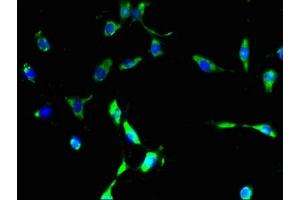 Immunofluorescent analysis of U251 cells using ABIN7164449 at dilution of 1:100 and Alexa Fluor 488-congugated AffiniPure Goat Anti-Rabbit IgG(H+L)