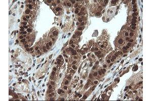 Image no. 6 for anti-Von Hippel-Lindau Tumor Suppressor, E3 Ubiquitin Protein Ligase (VHL) antibody (ABIN1501712)