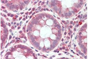 Human Colon: Formalin-Fixed, Paraffin-Embedded (FFPE)