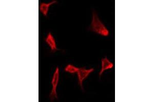ABIN6272275 staining HeLa by IF/ICC. (CMTM4 anticorps  (N-Term))