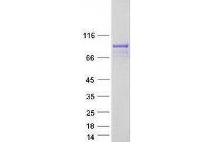 Validation with Western Blot