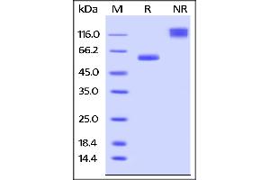 Human VSIG8, Fc Tag on  under reducing (R) and ing (NR) conditions. (VSIG8 Protein (AA 22-263) (Fc Tag))