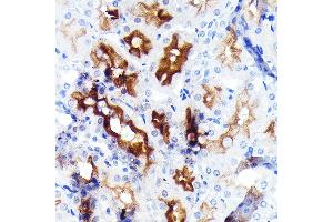 Immunohistochemistry of paraffin-embedded rat kidney using P Glycoprotein Rabbit mAb (ABIN7265732) at dilution of 1:100 (40x lens).