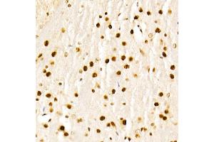 Immunohistochemistry of paraffin-embedded mouse brain using KA Rabbit pAb (ABIN1679964, ABIN5664011, ABIN5664013 and ABIN6219456) at dilution of 1:50 (40x lens).