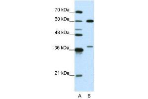 WB Suggested Anti-HNRPL  Antibody Titration: 0. (HNRNPL anticorps  (N-Term))