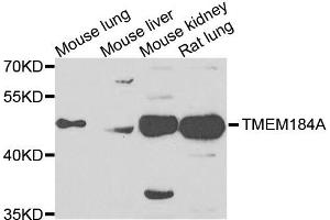 Western blot analysis of extracts of various cells, using TMEM184A antibody. (TMEM184A anticorps)