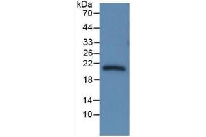 WB of Protein Standard: different control antibodies  against Highly purified E. (SERPINA6 Kit ELISA)