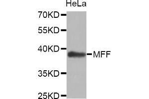 Western blot analysis of extracts of HeLa cells, using MFF antibody (ABIN5972807). (MFF anticorps)