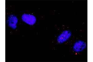 Proximity Ligation Analysis of protein-protein interactions between FLT1 and CRK.