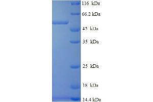 SDS-PAGE (SDS) image for Dehydrogenase/reductase (SDR Family) Member 7 (DHRS7) (AA 29-339) protein (His-SUMO Tag) (ABIN5712015)