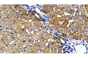 Detection of CK18 in Rat Liver Tissue using Polyclonal Antibody to Cytokeratin 18 (CK18)