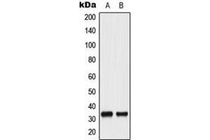 Western blot analysis of CDC2 (pY15) expression in HeLa UV-treated (A), A431 (B) whole cell lysates. (CDK1 anticorps  (N-Term, pTyr15))