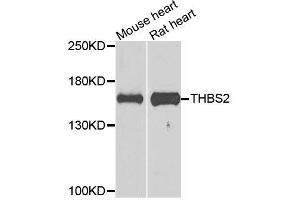 Western blot analysis of extracts of various cell lines, using THBS2 antibody (ABIN5996361) at 1/1000 dilution. (Thrombospondin 2 anticorps)