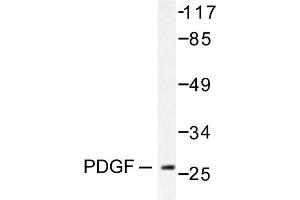 Image no. 1 for anti-Platelet Derived Growth Factor Subunit B (PDGFB) antibody (ABIN271781) (PDGFB anticorps)