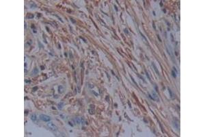 IHC-P analysis of Human Tissue, with DAB staining. (PDE4D anticorps  (AA 581-809))