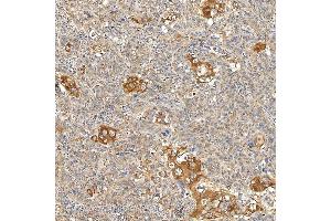 IHC analysis of SNPH using anti-SNPH antibody (ABIN7601724). (Syntaphilin anticorps  (AA 43-482))