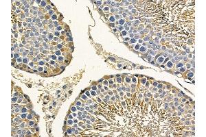 PKM2 Mouse Monoclonal Antibody at 1/100 staining rat testis tissue by IHC-P. (PKM2 anticorps  (Internal Region))