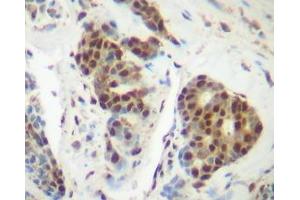 Image no. 1 for anti-Tumor Necrosis Factor alpha (TNF alpha) antibody (ABIN465605) (TNF alpha anticorps)