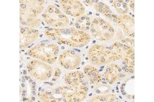 Immunohistochemistry analysis of paraffin-embedded human kidney using,MAP3K12 (ABIN7074679) at dilution of 1: 400 (MAP3K12 anticorps)