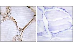 Immunohistochemistry (IHC) image for anti-BMX Non-Receptor Tyrosine Kinase (BMX) (AA 532-581) antibody (ABIN2888766) (BMX anticorps  (AA 532-581))